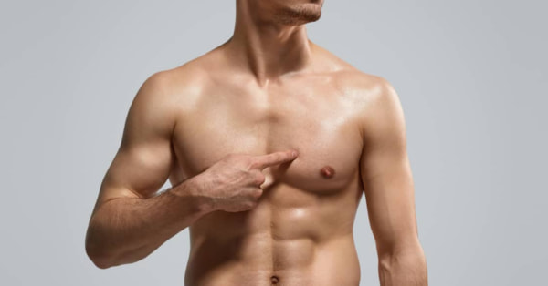 Ginekomastija i smanjenje muških grudi