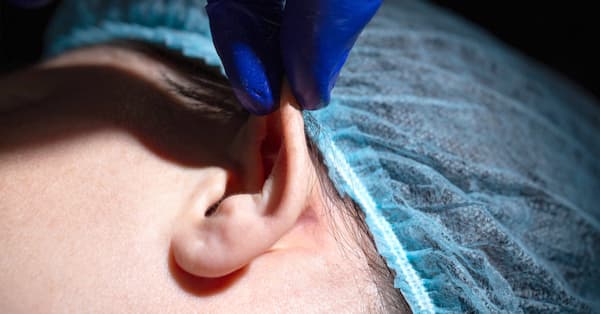 Ear Corrections: Otoplasty, Earlobes, and Other Surgeries